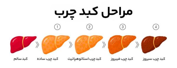 کدام گرید کبد چرب خطرناک است