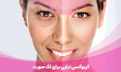 کربن تراپی برای لک صورت