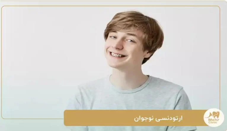 برترین خدمات ارتودنسی نوجوانان در کلینیک دندانپزشکی در شریعتی تهران