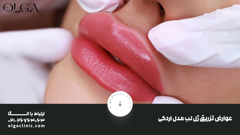 تزریق ژل | تزریق ژل لب عوارض تزریق ژل لب مدل اردکی