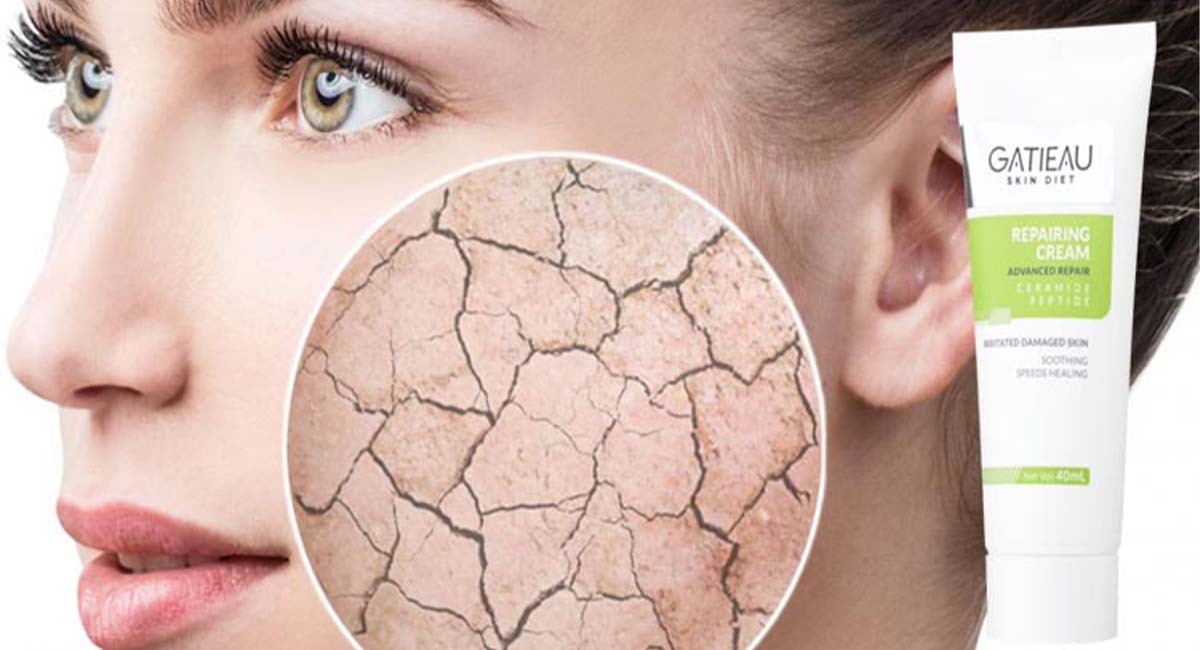 ضد آفتاب | سوختگی طریقه مصرف گام به گام کرم ترمیم کننده گاتیو